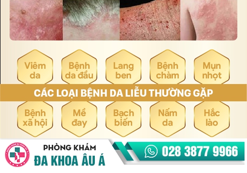 Các bệnh da liễu, bệnh xã hội thường gặp